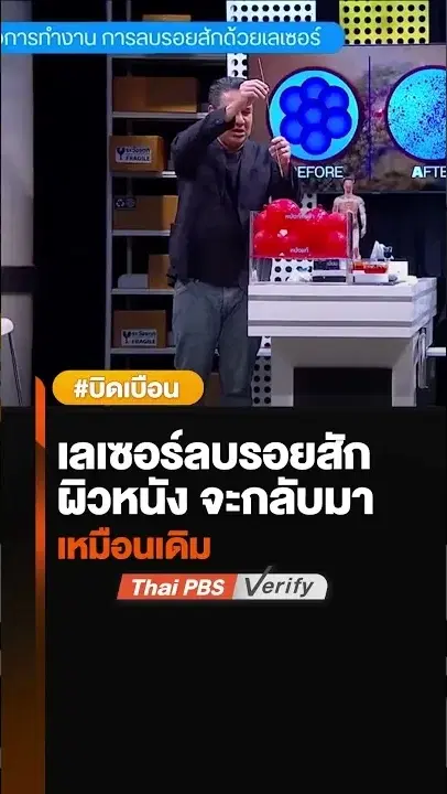 เลเซอร์ลบรอยสัก ผิวหนัง จะกลับมาเหมือนเดิม