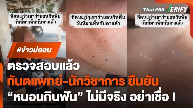 ตรวจสอบพบ : “ทันตแพทย์-นักวิชาการ” ยันชัด “หนอนกินฟัน” ไม่มีจริง !
