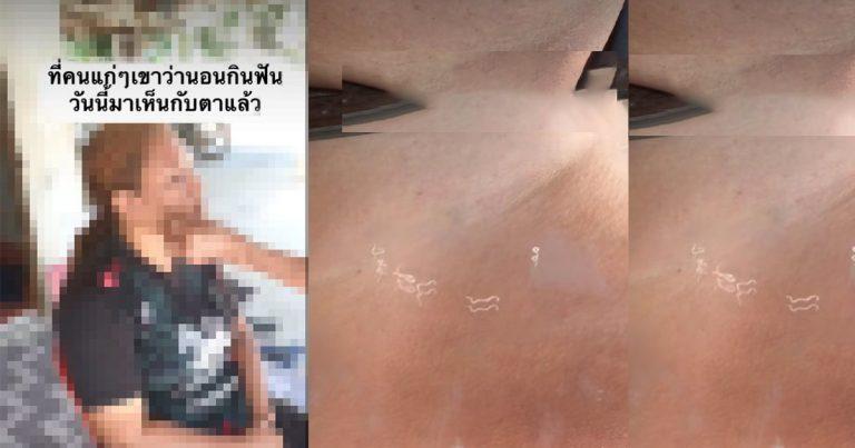 Verification : Dentists and Academics Confirm: “Tooth Worms” Do Not Exist!